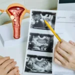 obstetrics gynecology department sahaj 1024x576